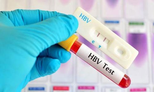 Nhiễm viêm gan B có chỉ số HBV-DNA 3580 copies cần điều trị không?