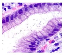Hình ảnh xoắn khuẩn H.Pylori được nhìn thấy dưới kính hiển vi