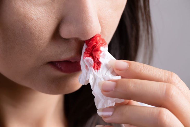 Chảy máu mũi sau khi test covid có nguy hiểm không?