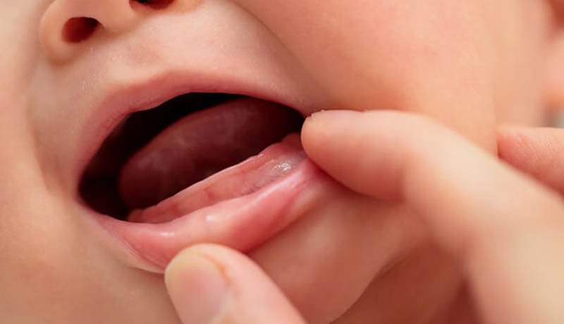 cách giúp trẻ nhanh mọc răng