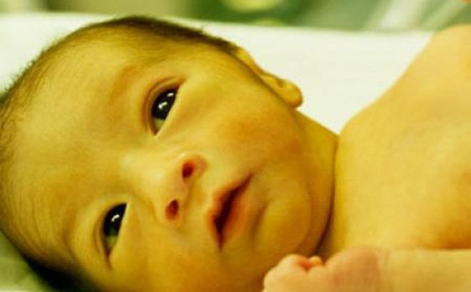 Trẻ sơ sinh bị vàng da kéo dài có nguy hiểm không?