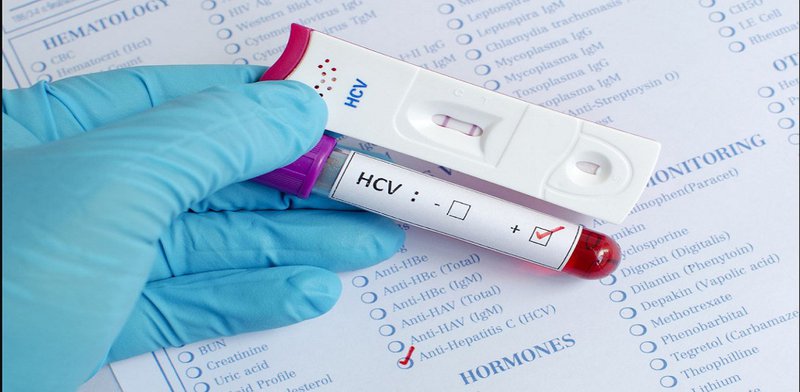 Nữ giới dương tính HCV điều trị như thế nào?