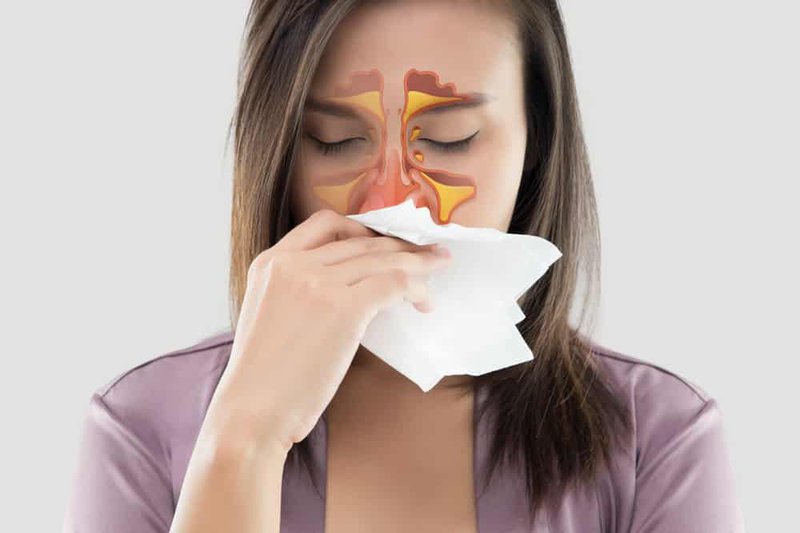 Người mắc bệnh lý viêm xoang có thể khiến hơi thở có mùi