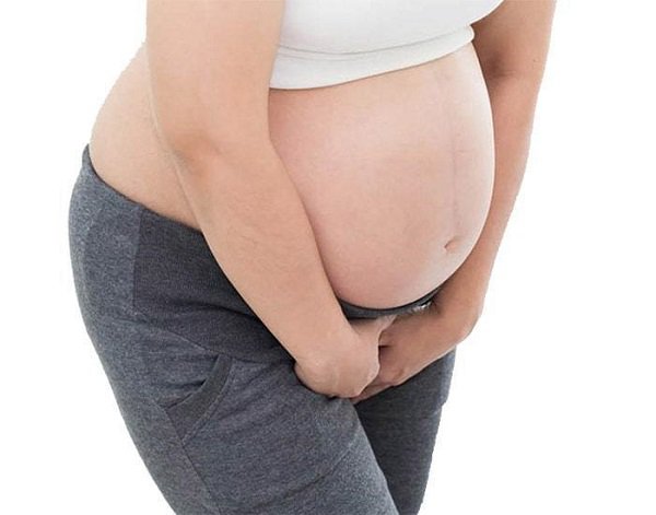 Điều trị tại nhà ngứa vùng kín khi mang thai 35 tuần như thế nào?