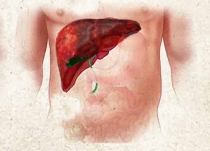 Cơ chế đông máu trong xơ gan thường bất thường do huyết khối và xuất huyết