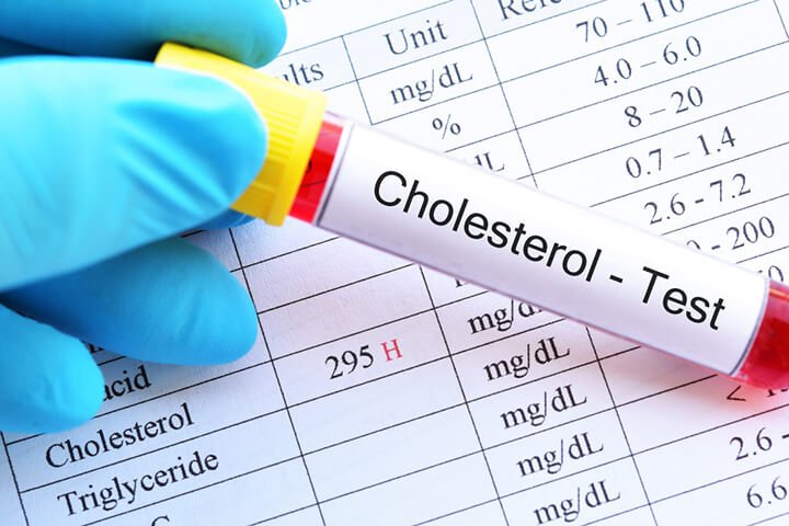 tỷ lệ cholesterol là gì