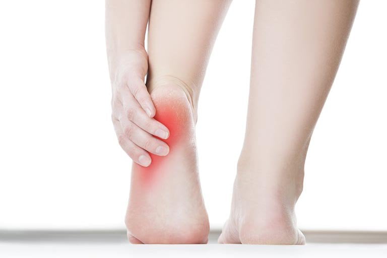 Mỏi chân trái kèm đau gót chân dấu hiệu bệnh gì?