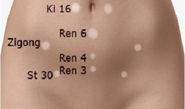 ST30 và Ren6 được sử dụng bấm huyệt kích thích ham muốn