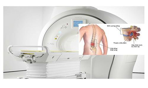 Nam giới chụp MRI lưng sau bao lâu chụp chân?
