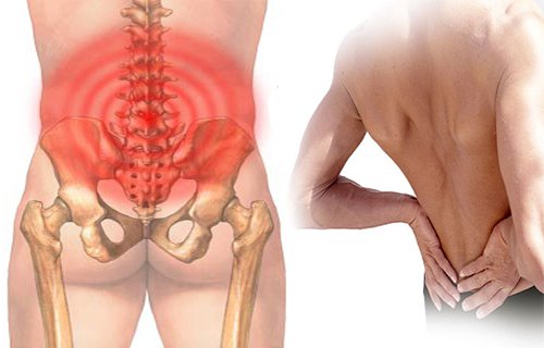 Nam giới đau vùng thắt lưng là dấu hiệu bệnh gì?