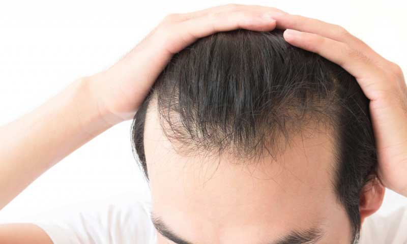 Nên cấy tóc ở bệnh viện nào? Top 11 địa chỉ cấy tóc uy tín nhất - VIỆN CẤY  TÓC TỰ THÂN NEWHAIR BY KHƠ THỊ