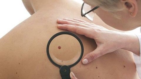 Cách chăm sóc da sau khi bị ung thư hắc tố