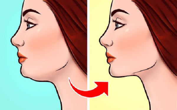 What is mewing jaw?