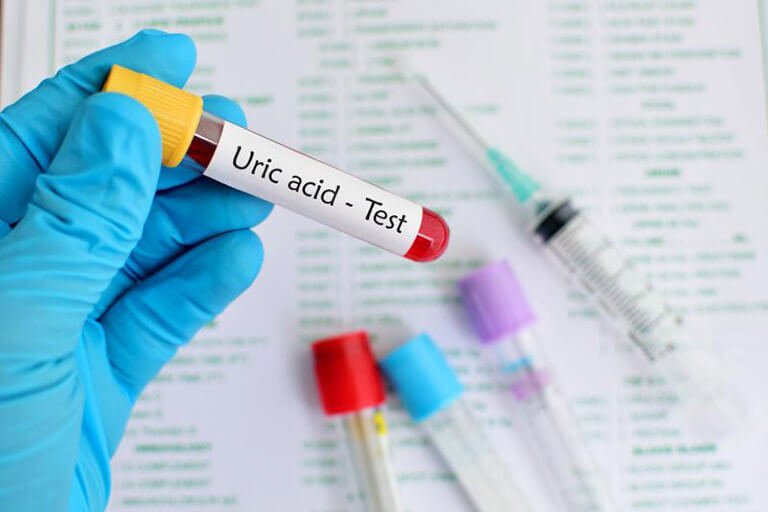 Cách giảm acid uric tự nhiên