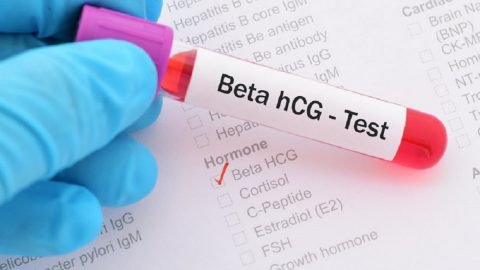 Trễ kinh kèm xét nghiệm beta HCG 345UI/ L có mang thai không?