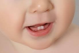 Trẻ 7 tuổi không mọc răng cửa khi thay răng sữa có sao không?