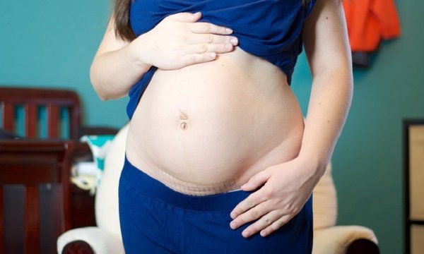 Mang thai lần hai sau sinh mổ 9 tháng