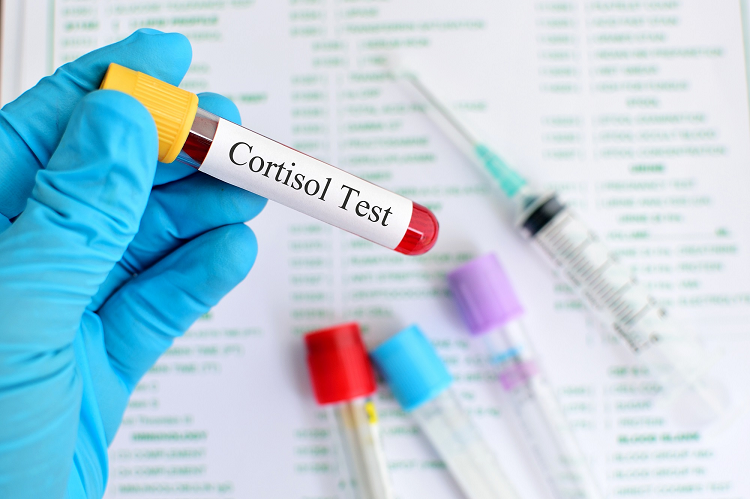 What does the Cortisol test mean?