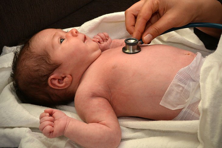 dấu hiệu viêm phổi ở trẻ 6 tháng