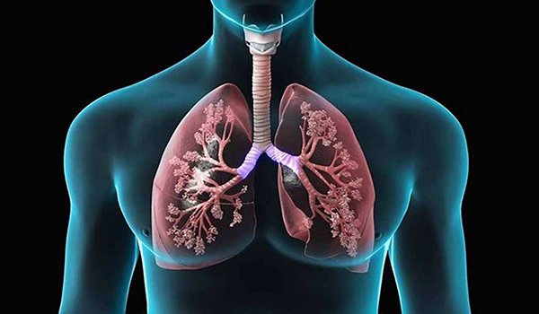 thuốc điều trị bệnh lao phổi