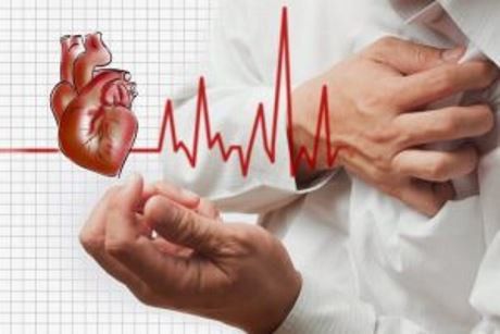 Is chronic ischemic heart disease a myocardial infarction?
