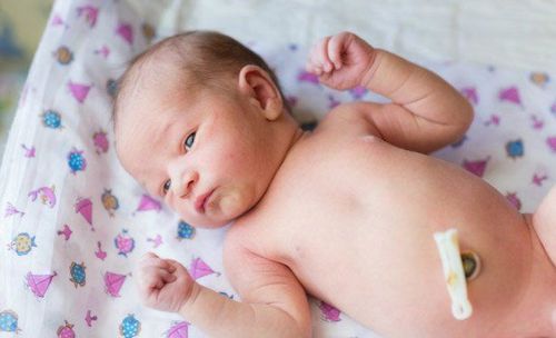 Be careful if the newborn's navel is wet and has a foul smell