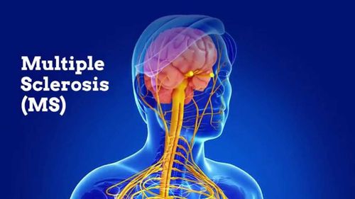 What is multiple sclerosis?