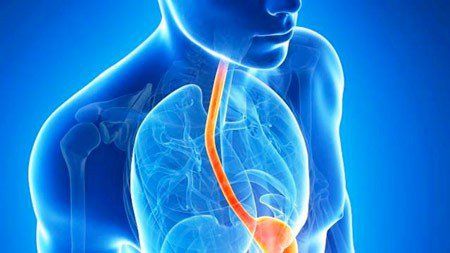 Reflux Esophageal Disease - A dangerous but underrated disease