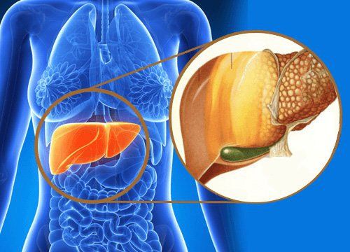 Distinguish between alcoholic and non-alcoholic fatty liver