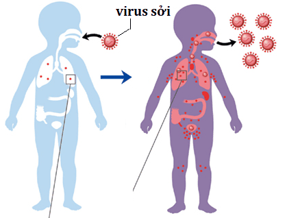 
Cơ chế lây truyền của Virus Sởi
