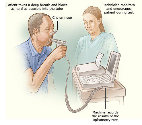 
Xét nghiệm hơi thở làMột trong những phương pháp xét nghiệm không xâm nhập được áp dụng khá phổ biến ở nhiều nước
