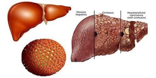 7 most basic questions about hepatitis B answered by the World Health Organization