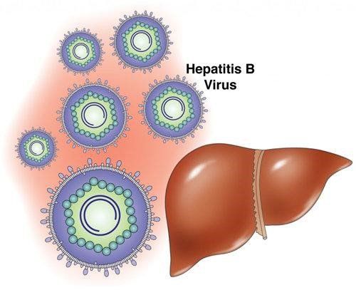 
Bệnh viêm gan B và virus viêm gan B
