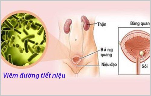 9. Các Câu Hỏi Thường Gặp Về Viêm Đường Tiểu