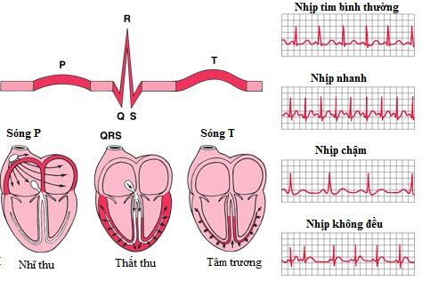 
Xét nghiệm ghi lại hoạt động điện của tim, có thể giúp chẩn đoán các rối loạn nhịp tim và phát hiện các vấn đề của cơ tim.
