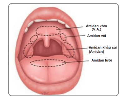 Location and role of tonsils - Why do children often get tonsillitis?