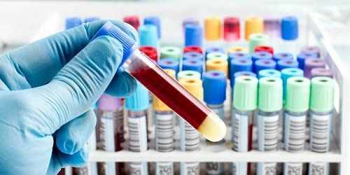 Can blood tests detect cancer?