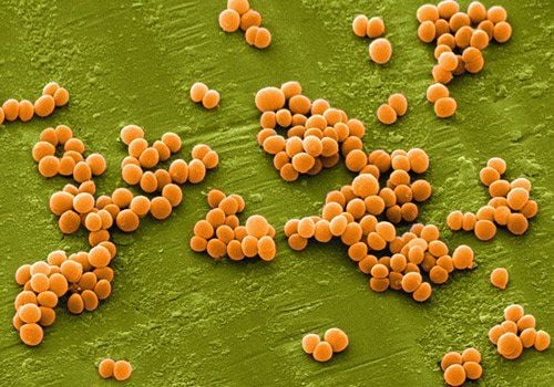 
Hình ảnh tụ cầu vàng (Staphylococcus aureus)
