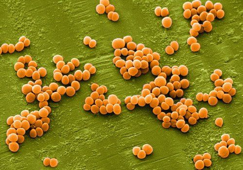 
Hình ảnh tụ cầu vàng (Staphylococcus aureus)
