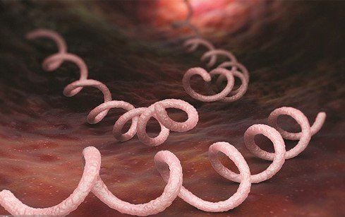 Understanding neurosyphilis and visual syphilis