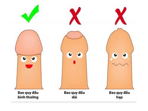 Why is circumcision necessary? When should circumcision be performed?