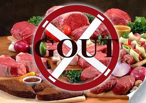 Gout patients should know: Purine content in foods