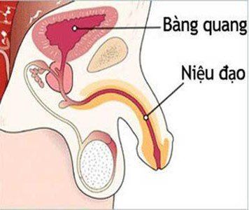 
Hẹp niệu đạo ở nam giới
