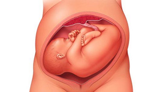 What is the throne? Common abnormalities in the fetal position