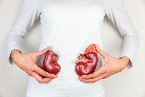 Simple kidney cyst: What you need to know