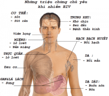 HIV biểu hiện bệnh sau bao lâu?