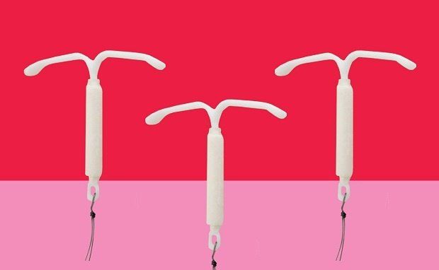 Pros and cons of the hormonal IUD