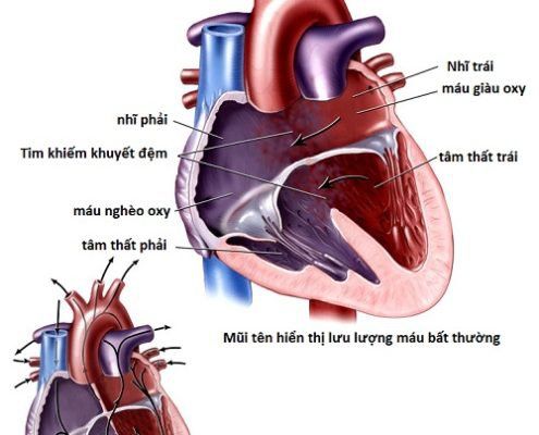 
Hình ảnh giải phẫu kênh nhĩ thất
