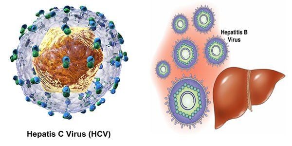 4. Các Biến Chứng Của Viêm Gan C