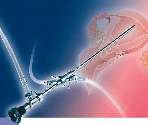 Purpose of hysteroscopy